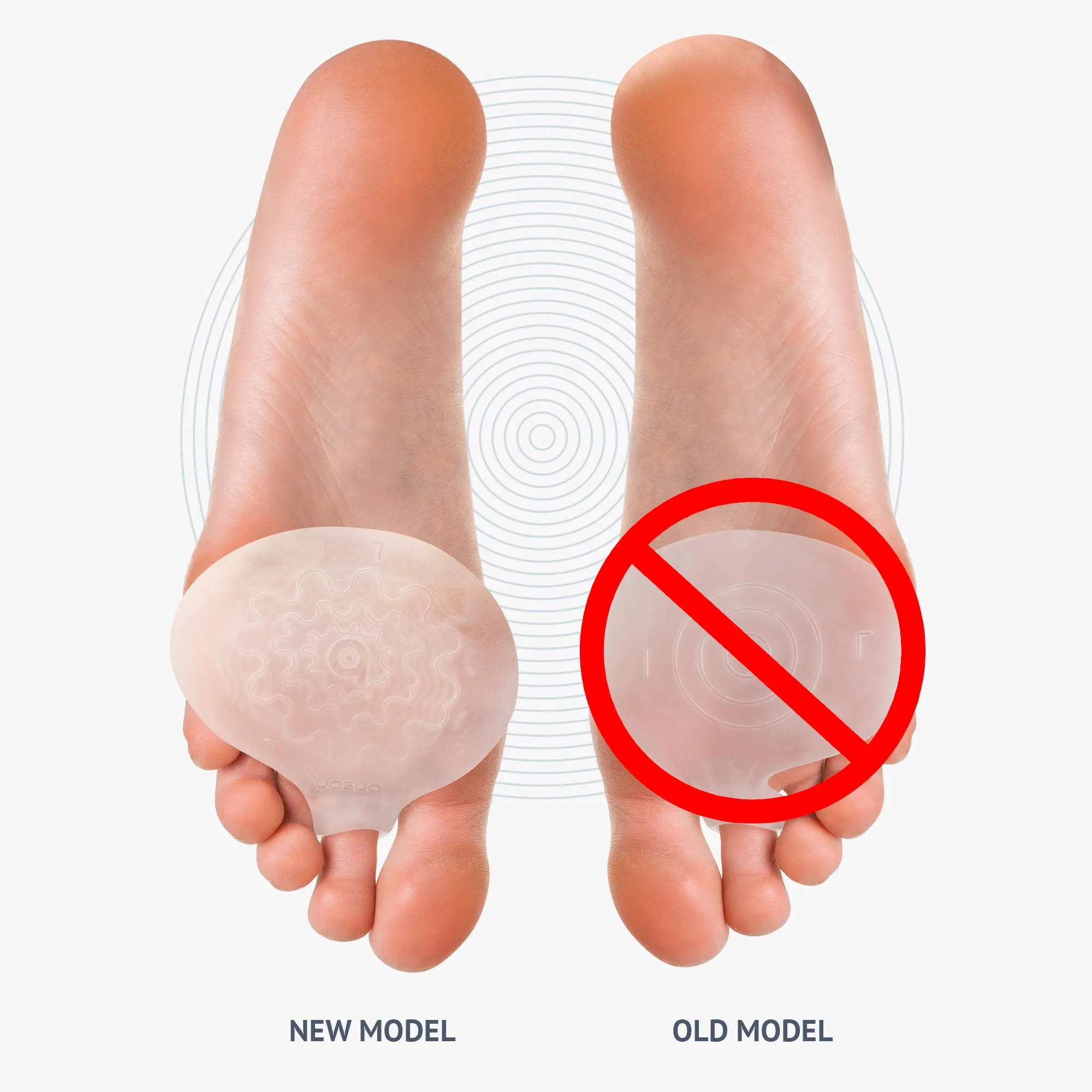 Metatarsal Pads